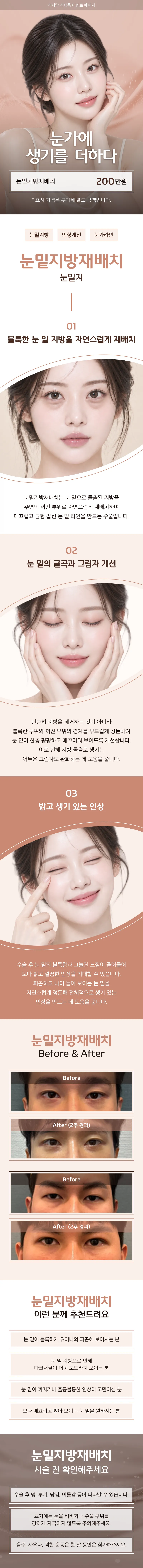 대표원장직접수술 ) 눈가에 생기를 더하다 눈밑지방재배치