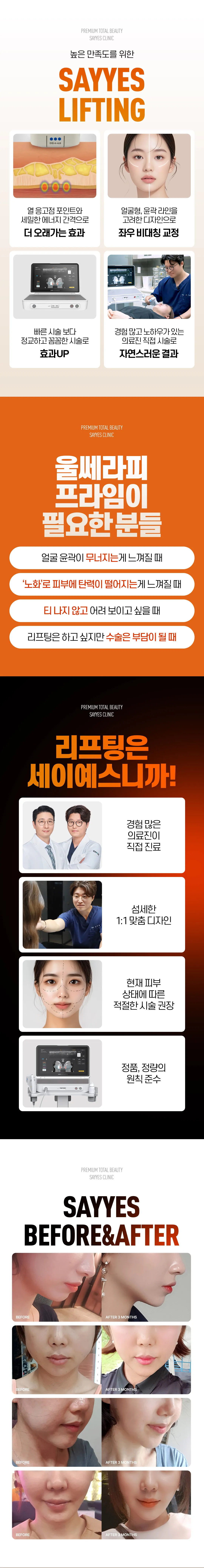 세이예스의원  탄력, 얼굴 라인, 이중턱, 주름 개선 울쎄라피프라임 이벤트, 시술 상세 이미지