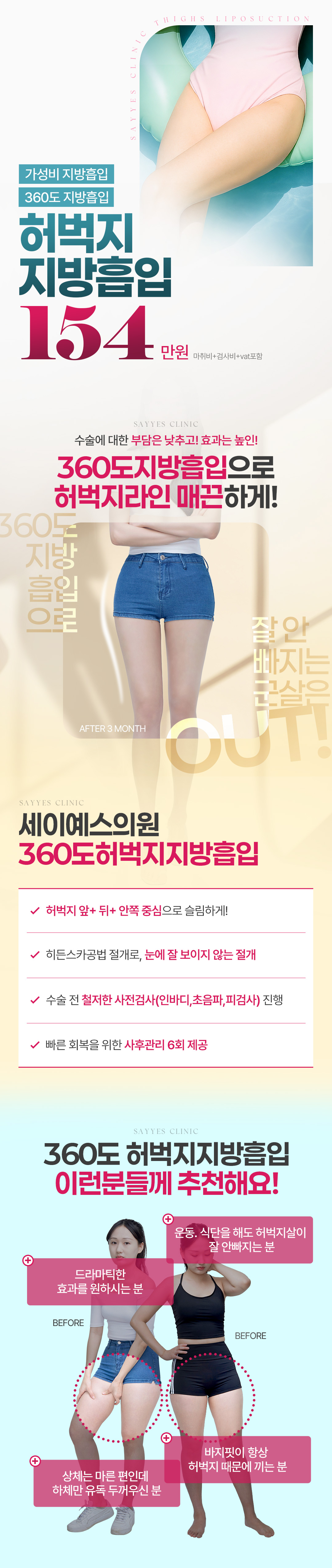 세이예스의원 대용량 허벅지전체지방흡입으로 날씬한 허벅지 이벤트, 시술 상세 이미지