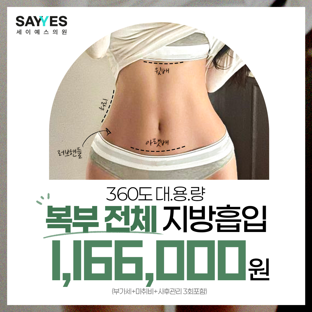 대용량 복부전체지방흡입, 앞복부+옆구리+러브핸들 흡입 이벤트 썸네일 이미지