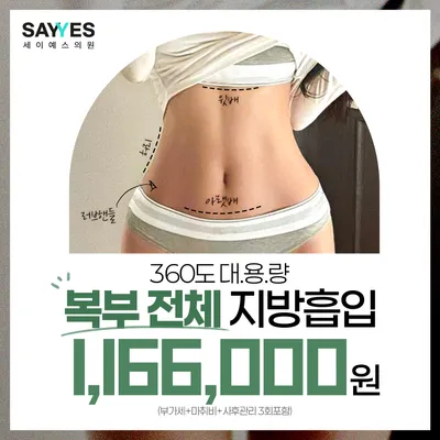대용량 복부전체지방흡입, 앞복부+옆구리+러브핸들 흡입 이벤트 썸네일 이미지