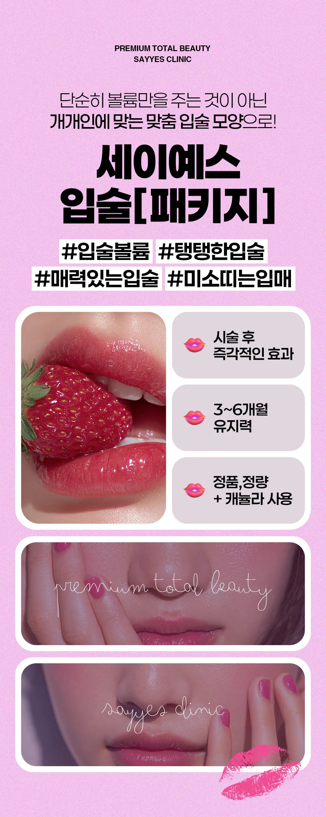 세이예스의원 입술패키지 이벤트_입꼬리필러,입꼬리보톡스,입술필러까지! 이벤트, 시술 상세 이미지