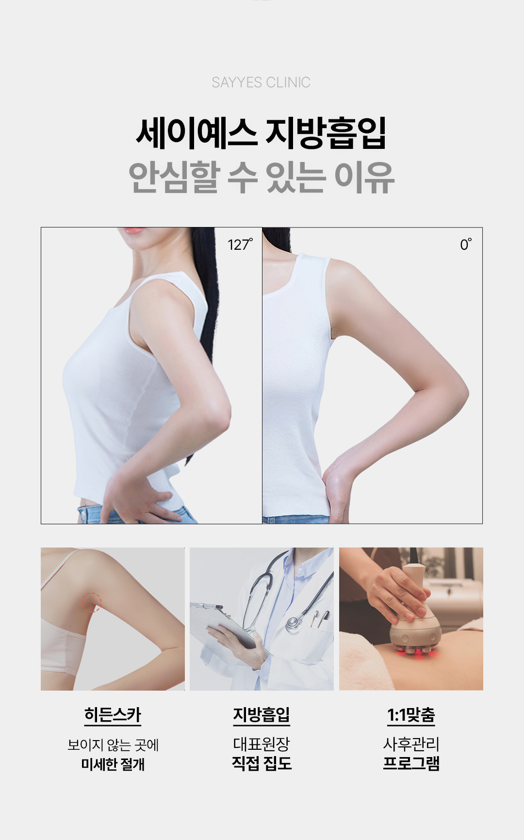 세이예스의원 대용량 팔전체지방흡입 여리여리한 일자 팔뚝완성 이벤트, 시술 상세 이미지