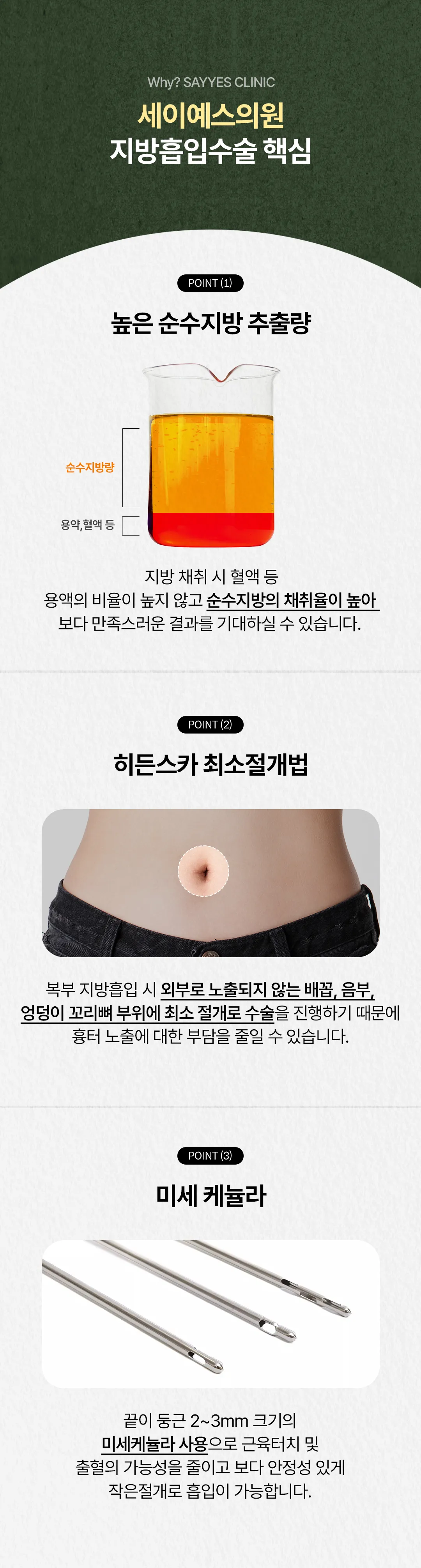 세이예스의원 대용량 복부전체지방흡입, 앞복부+옆구리+러브핸들 흡입 이벤트, 시술 상세 이미지