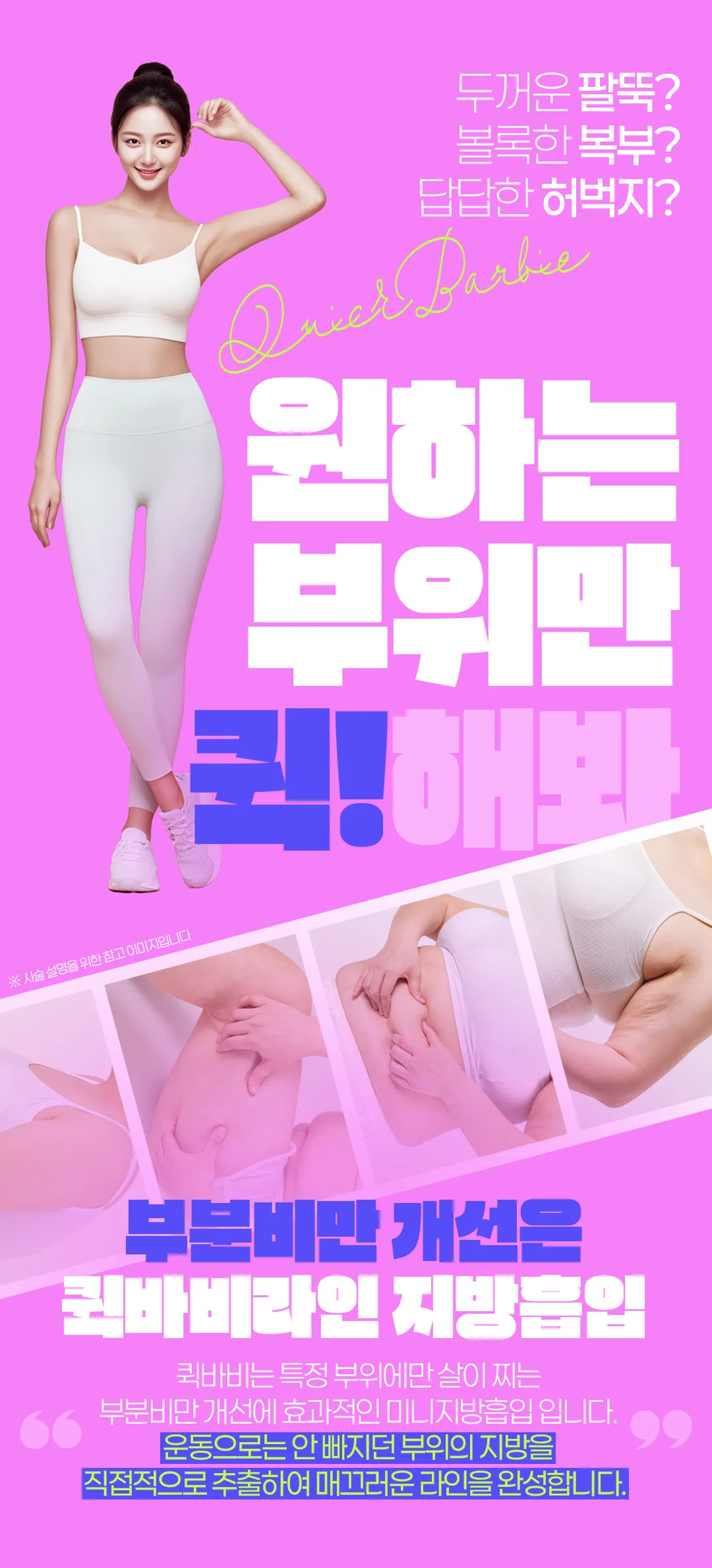 세이예스의원 대용량 부위별 지방흡입, 압박복 X, 다음날 출근 가능 이벤트, 시술 상세 이미지