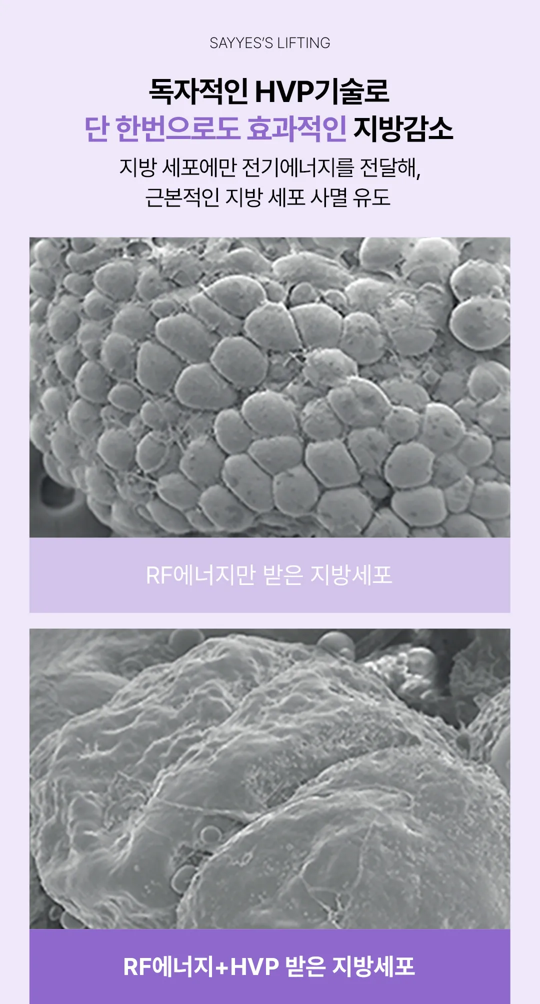 세이예스의원 인모드 FX FORMA 풀페이스 이벤트 이벤트, 시술 상세 이미지