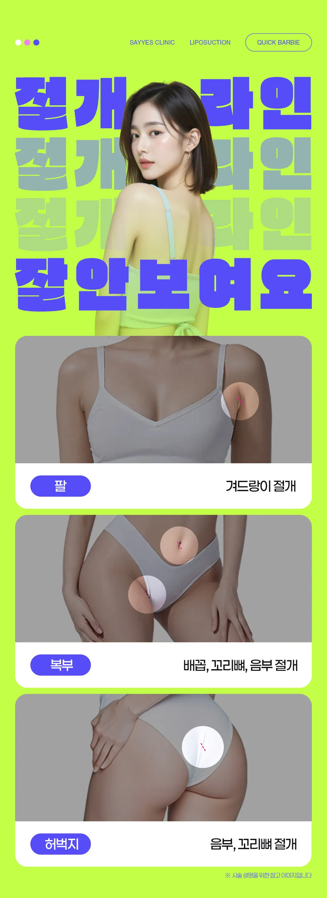 세이예스의원 대용량 부위별 지방흡입, 압박복 X, 다음날 출근 가능 이벤트, 시술 상세 이미지