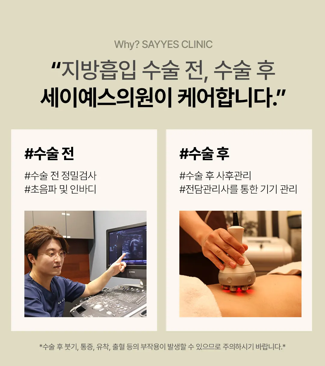 세이예스의원 대용량 복부전체지방흡입, 앞복부+옆구리+러브핸들 흡입 이벤트, 시술 상세 이미지