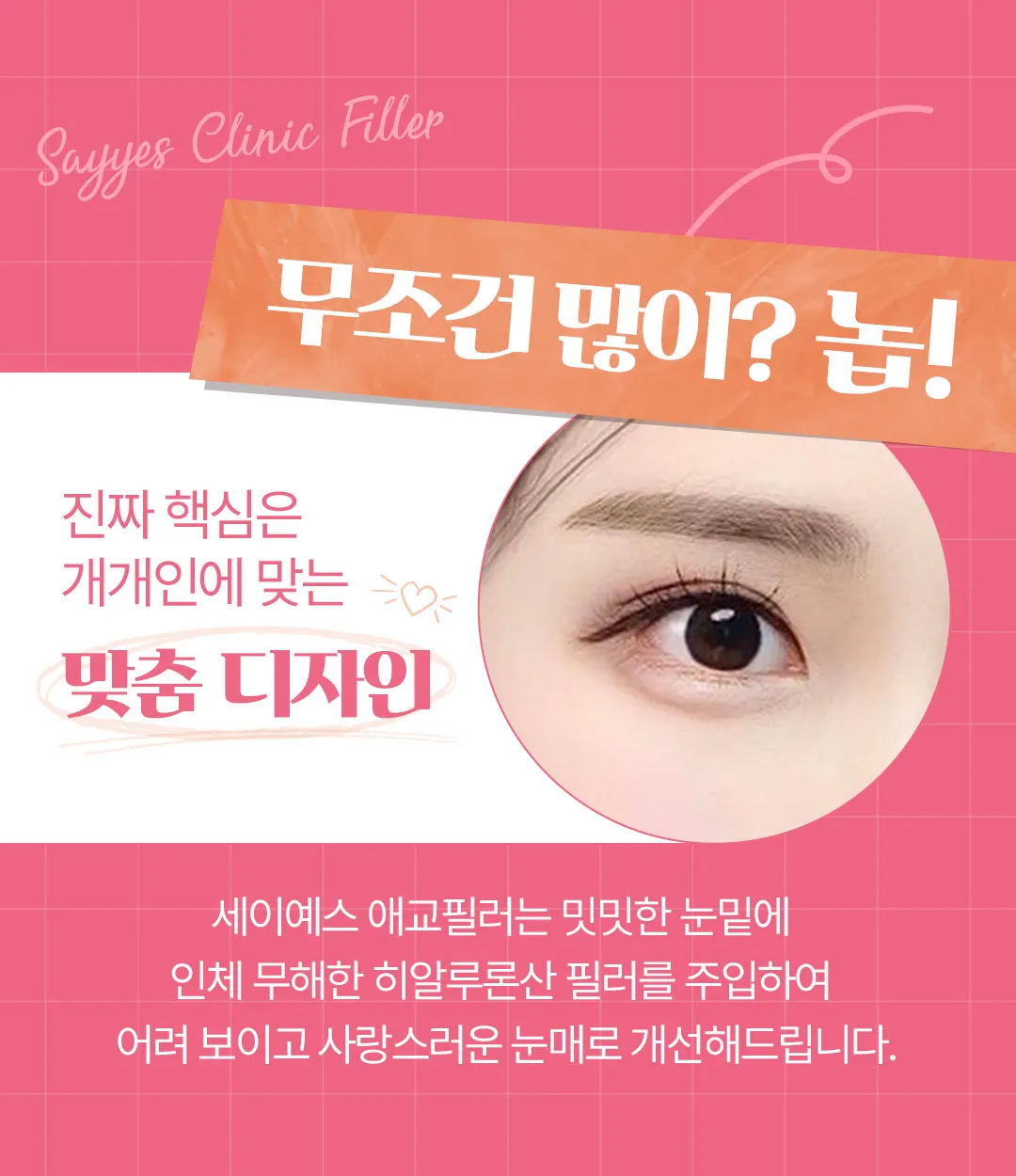 세이예스의원 자연스러운 애교살! 애교필러로 봉긋하게! 이벤트, 시술 상세 이미지