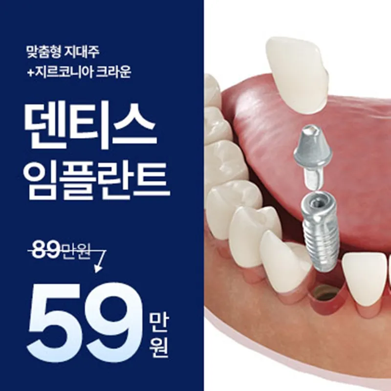 정품 덴티스 임플란트 59만원 이벤트 - 전문의 진료