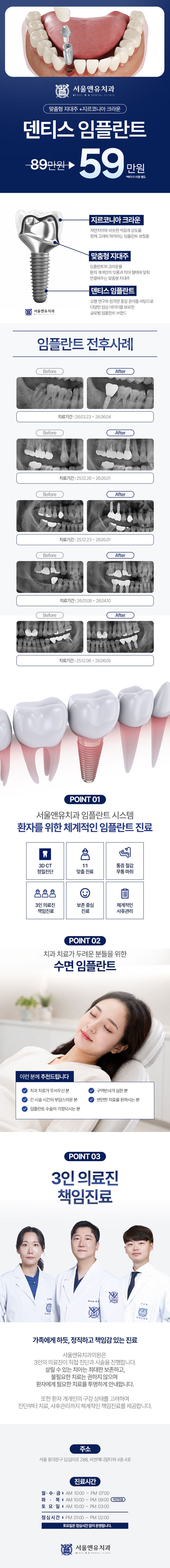 정품 덴티스 임플란트 59만원 이벤트 - 전문의 진료