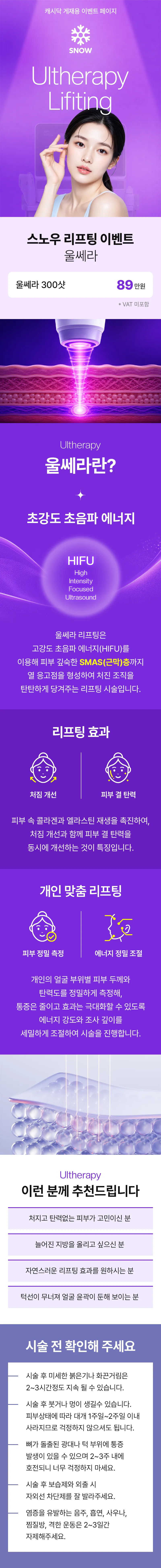 울쎄라 리프팅 300샷