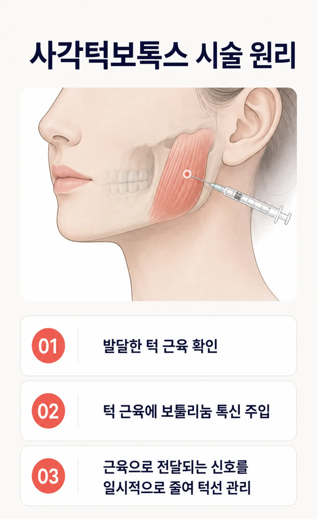사각턱보톡스 동성로 특가