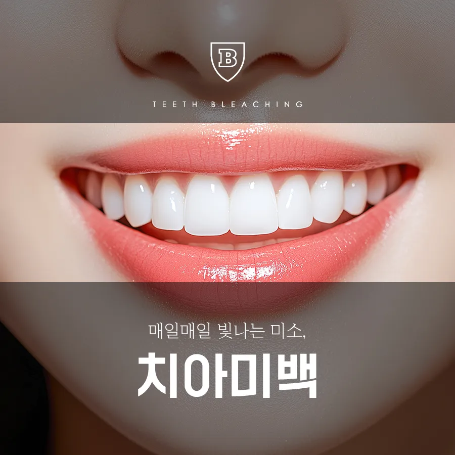 원데이 치아미백 3회 풀코스(스케일링 포함)