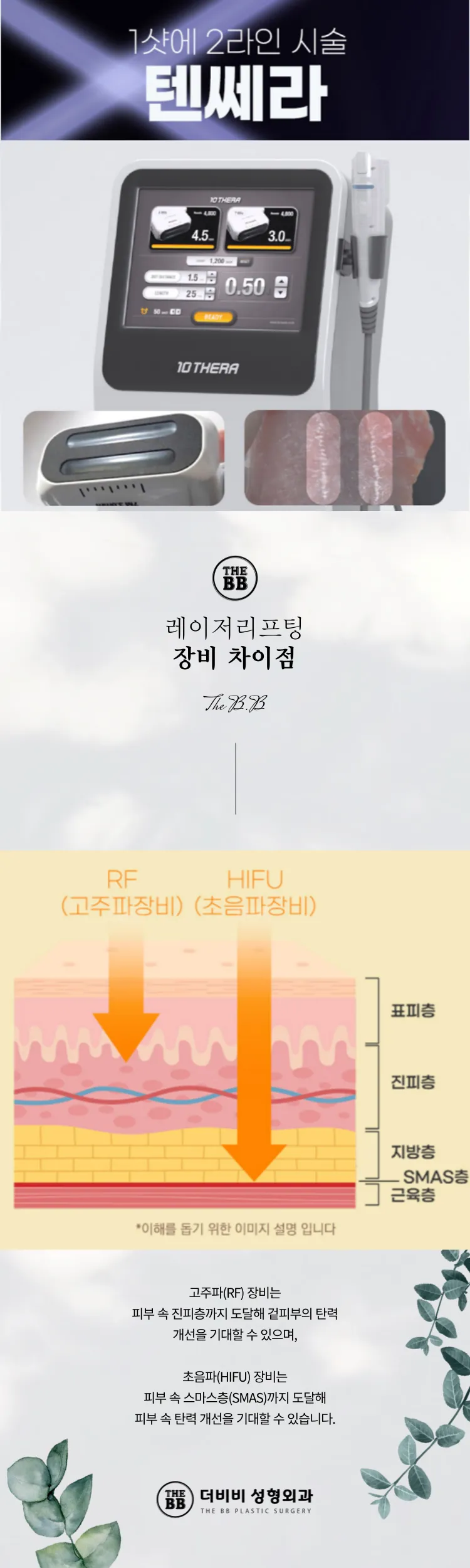 초음파 리프팅 텐쎄라
