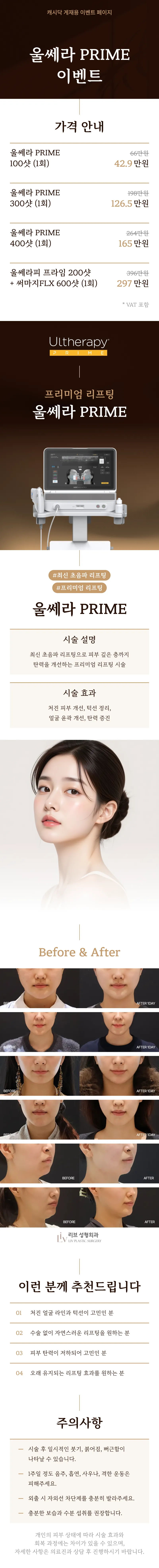 울쎄라피 프라임 100샷