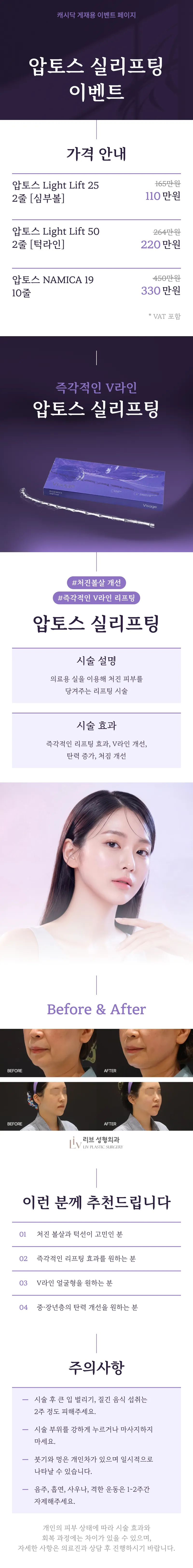 압토스 실리프팅 Light Lift 25(2줄) 얼굴선