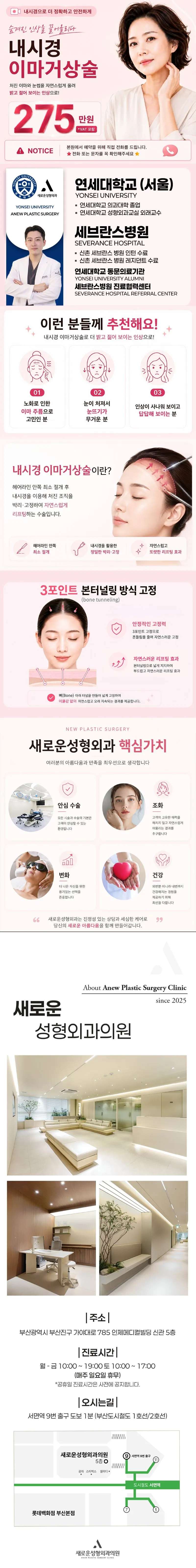 [새로운] 내시경이마거상술