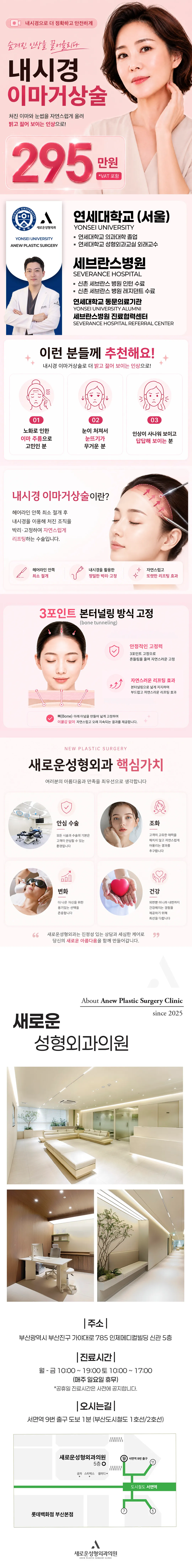 [새로운] 내시경이마거상술