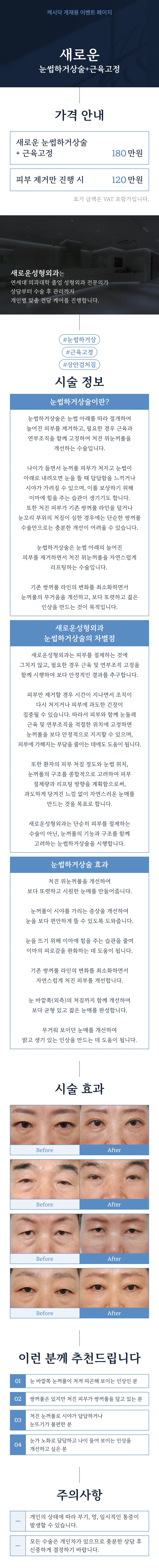 [새로운] 눈썹하거상술 + 근육고정