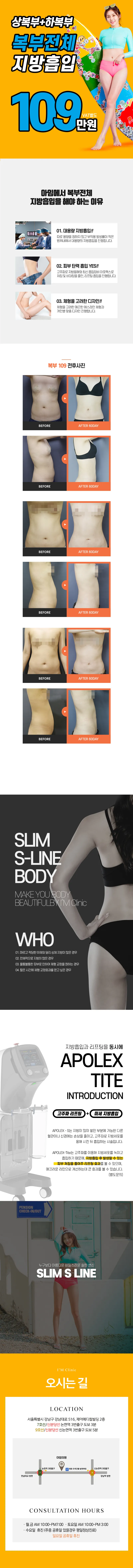 복부 싸그리 지방흡입