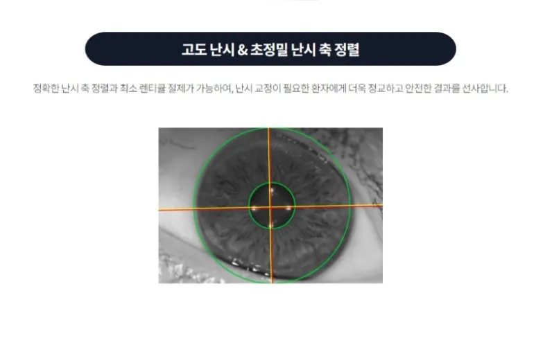클리어 수프라 라식