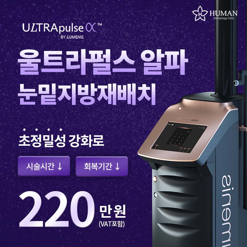 울트라펄스알파 레이저 눈밑지방재배치