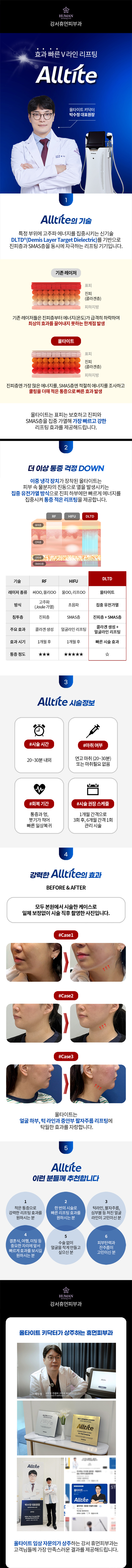 통증 적은 리프팅 올타이트 400샷 | 피부과전문의