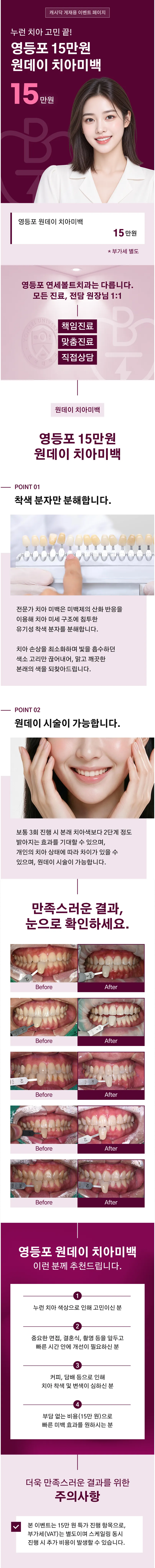 하루만에 누렁니 탈출! 원데이 치아미백 3회