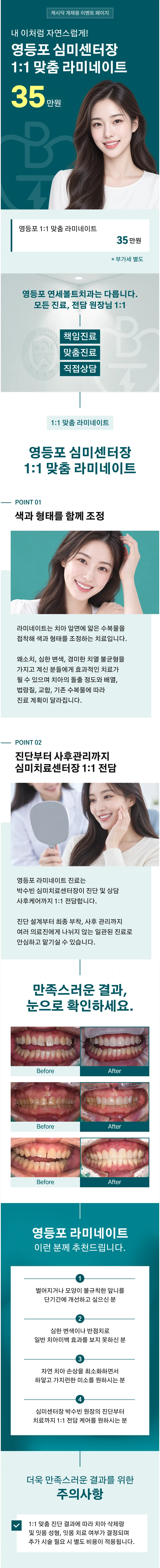 심미센터장 1:1 맞춤 라미네이트