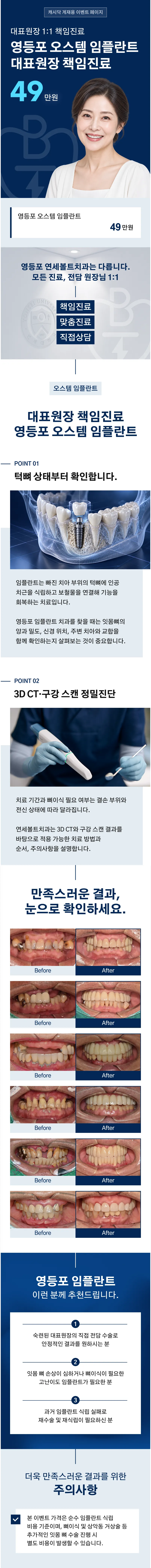 영등포역 임플란트 (대표원장 전담)