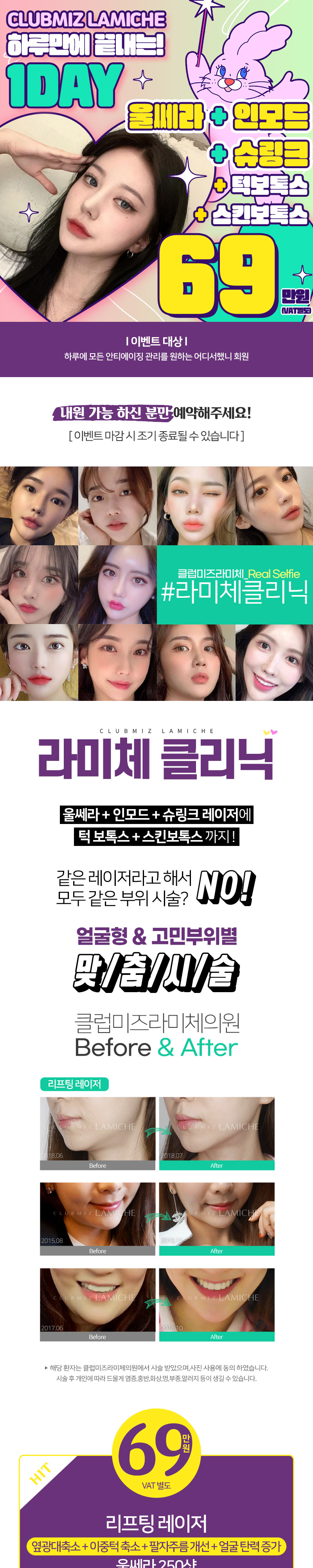 클럽미즈라미체의원 라미체❤리프팅 끝판왕 이벤트, 시술 상세 이미지
