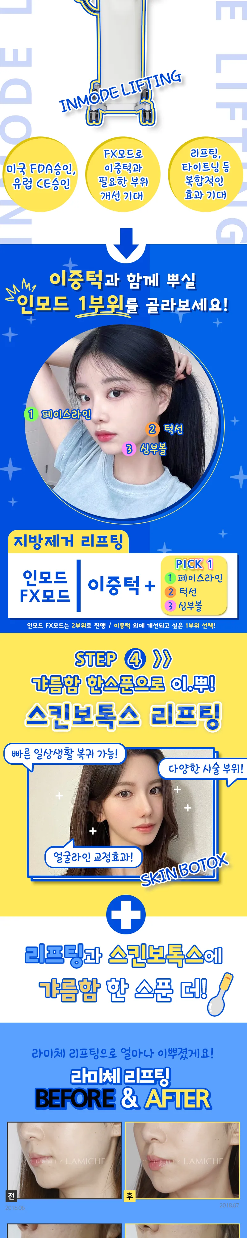 클럽미즈라미체의원 울+슈+인💛이뿌리프팅 이벤트, 시술 상세 이미지