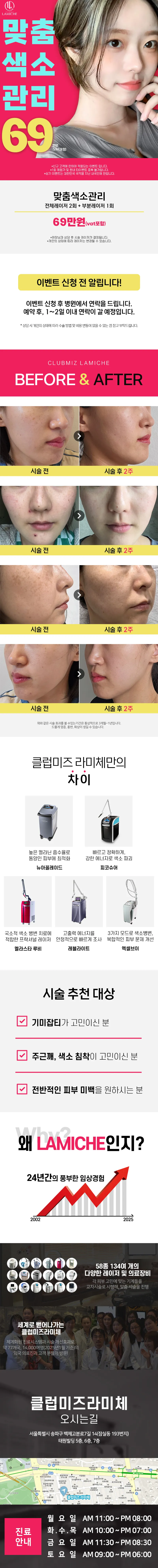 맞춤색소관리_클럽미즈라미체