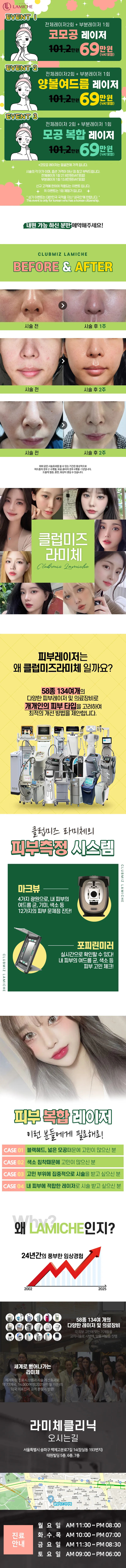 클럽미즈라미체의원 피부 복합 레이저 이벤트, 시술 상세 이미지