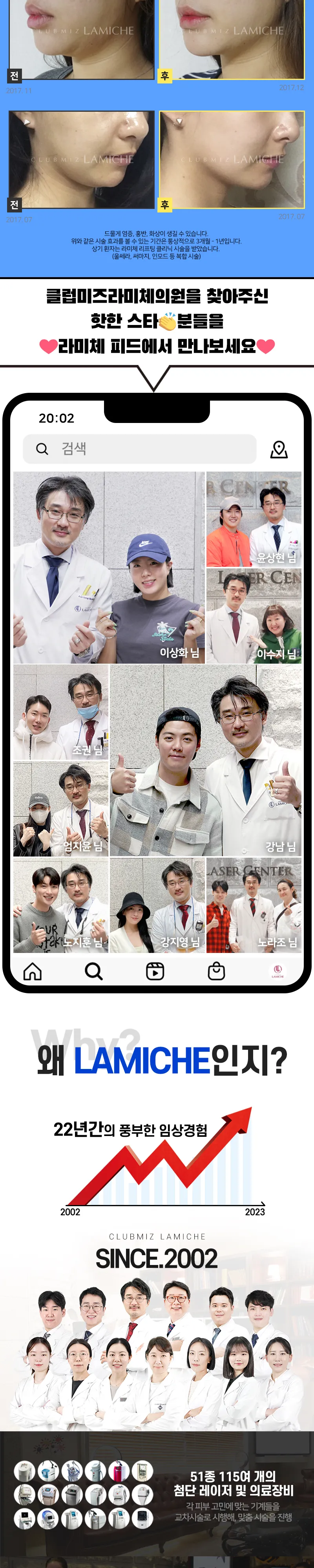 클럽미즈라미체의원 울+슈+인💛이뿌리프팅 이벤트, 시술 상세 이미지