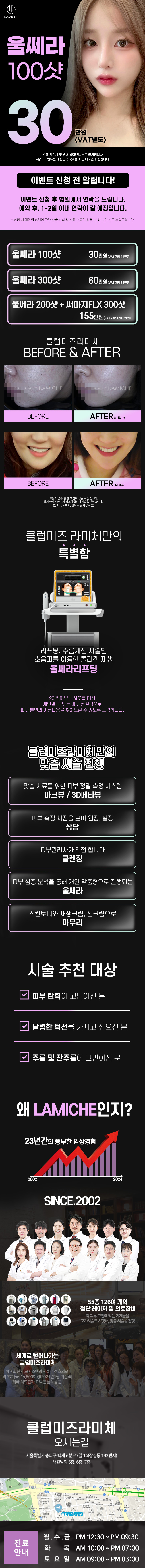 클럽미즈라미체의원 울쎄라_클럽미즈라미체 이벤트, 시술 상세 이미지
