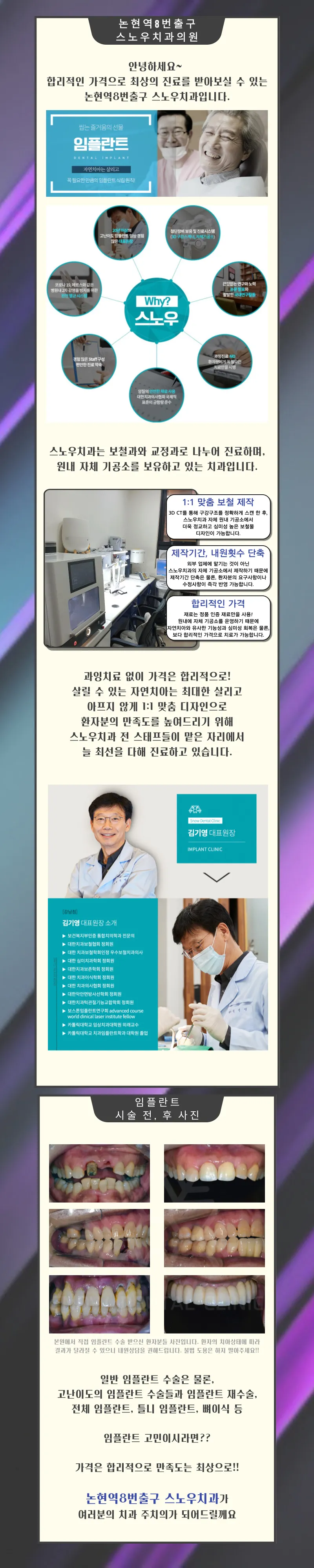 스노우치과의원 내 치아같이 편안한 임플란트! 이벤트, 시술 상세 이미지