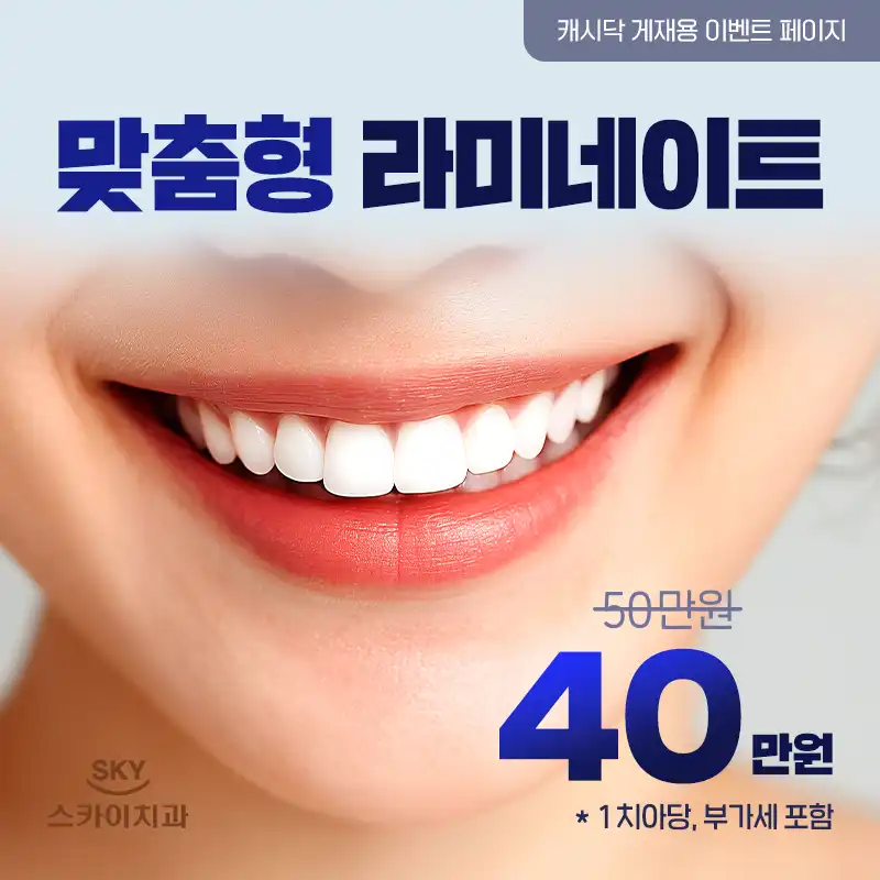 맞춤형 라미네이트