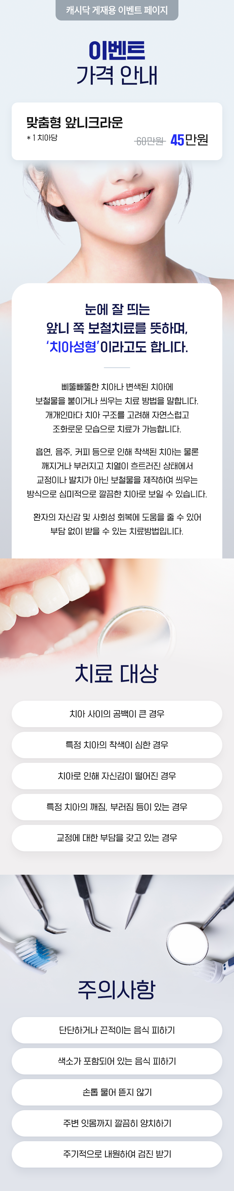 스카이치과의원 맞춤형 앞니크라운 이벤트, 시술 상세 이미지