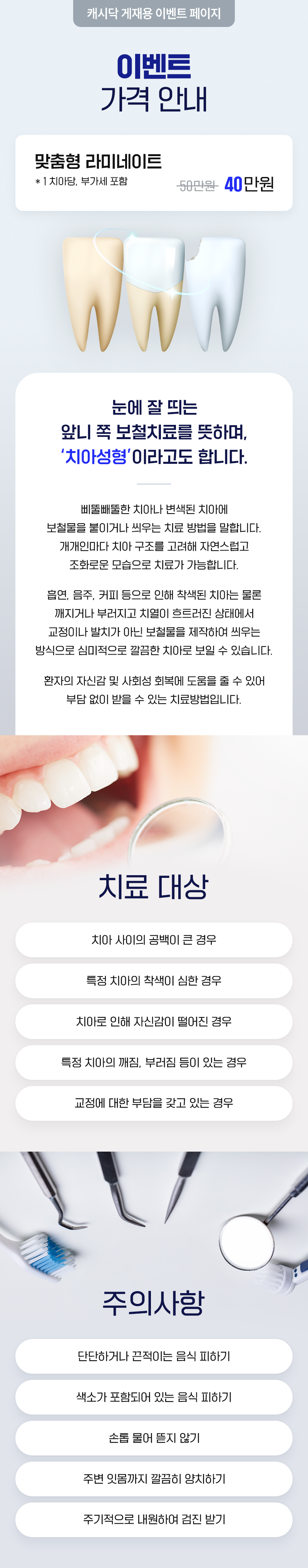 스카이치과의원 맞춤형 라미네이트 이벤트, 시술 상세 이미지