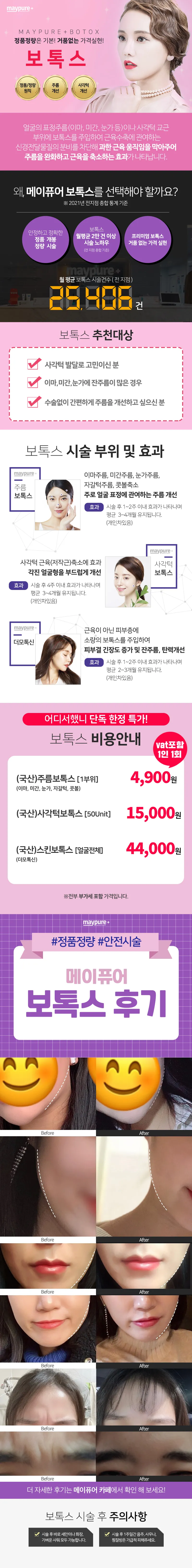 메이퓨어의원 영등포점 영등포점_부위별 보톡스 4,900원~ 이벤트, 시술 상세 이미지