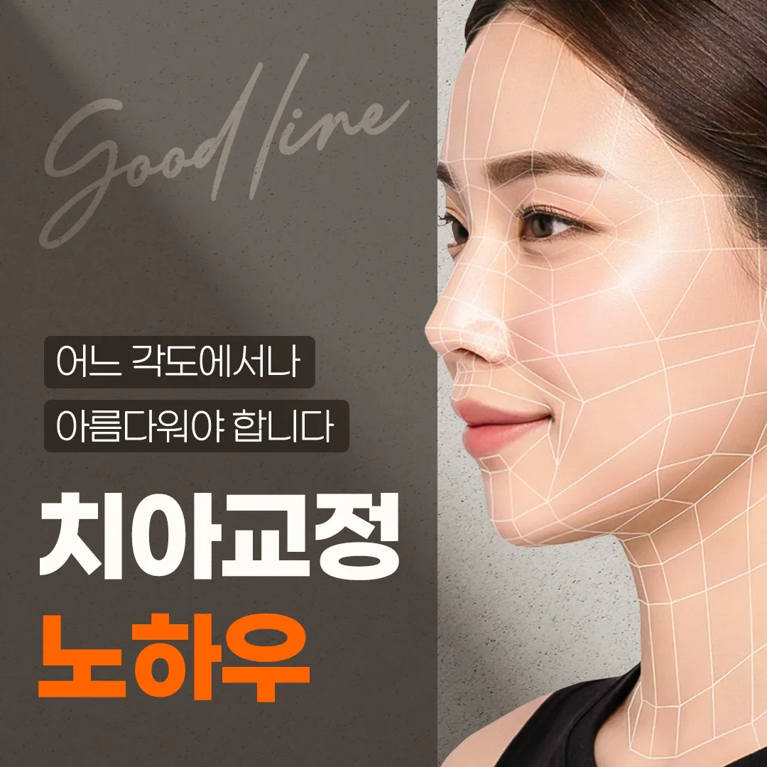 나에게 꼭 맞춘 Good-line 치아교정