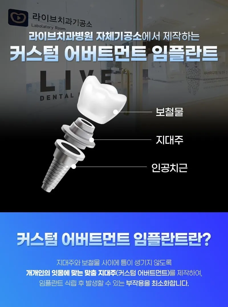 라이브치과병원 서울강남 오스템 전체임플란트!당일식립,주말진료 이벤트, 시술 상세 이미지