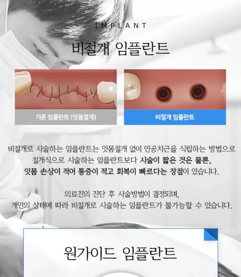 라이브치과병원 서울강남 오스템 전체임플란트 할인! 추가비용X 이벤트, 시술 상세 이미지