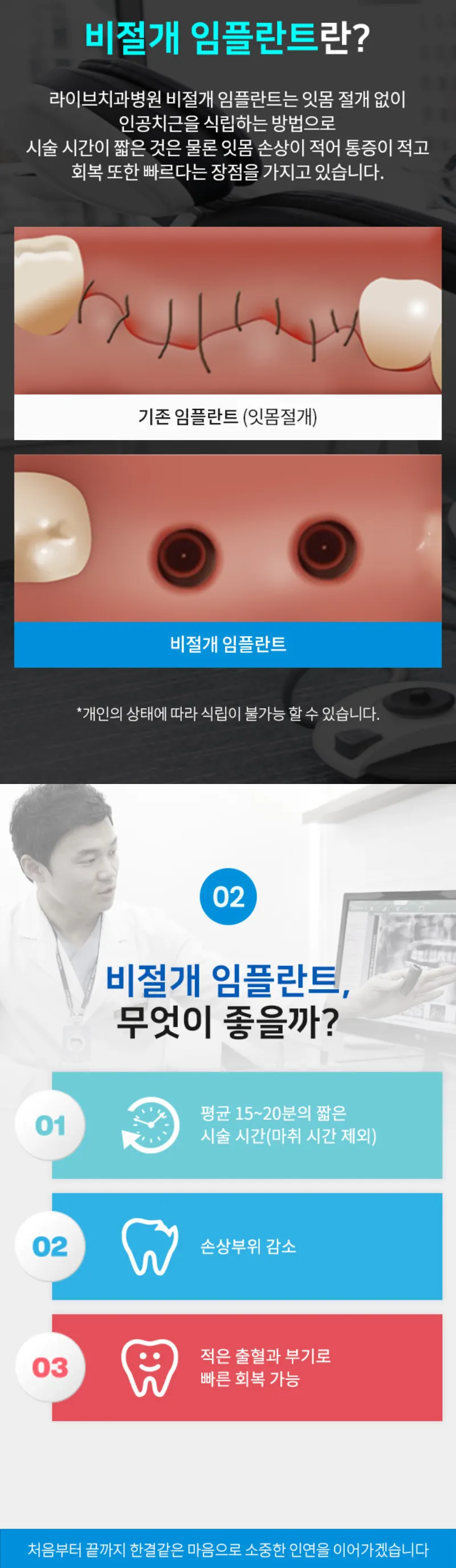 라이브치과병원 서울강남 오스템 전체임플란트!당일식립,주말진료 이벤트, 시술 상세 이미지