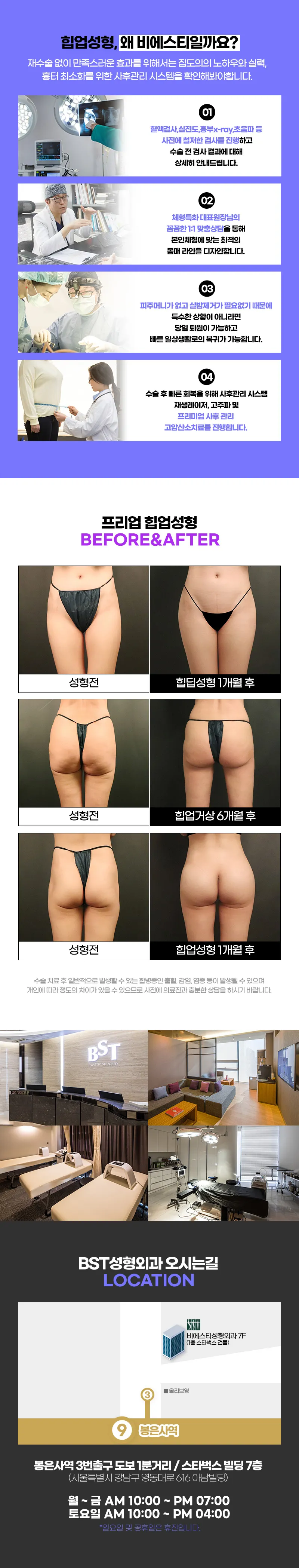 비에스티성형외과 ❤️고관절 지방이식❤️ 이벤트, 시술 상세 이미지