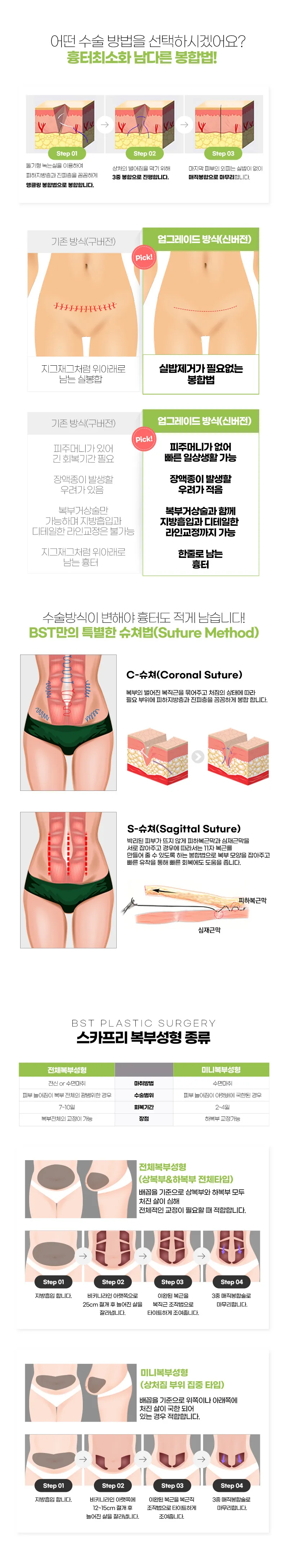 비에스티성형외과 ❤️스카프리 미니복부성형❤️ 이벤트, 시술 상세 이미지
