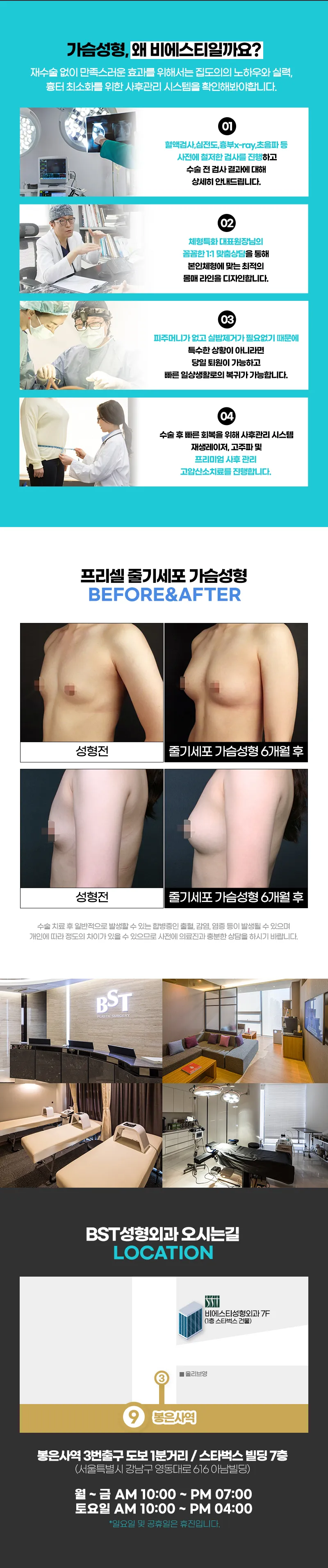 비에스티성형외과 ❤️줄기세포 가슴성형❤️ 이벤트, 시술 상세 이미지