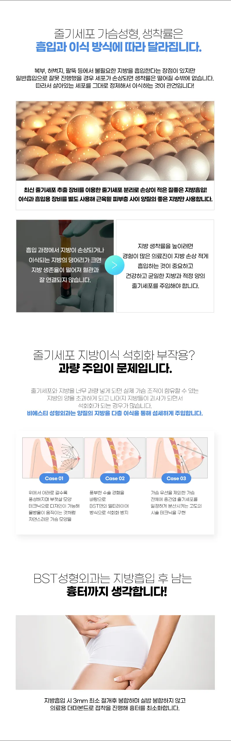 비에스티성형외과 ❤️줄기세포 가슴성형❤️ 이벤트, 시술 상세 이미지